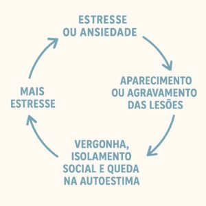Imagem mostrando um ciclo vicioso que se repete, mostrando a relação entre psoríase e estresse, com as seguintes etapas: Estresse ou ansiedade 🡪 Aparecimento ou agravamento das lesões 🡪 Vergonha, isolamento social e queda na autoestima  🡪 Mais estresse 🡪 Piora do quadro
