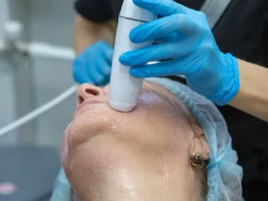 Mulher passando por tratamento de dermatologia estética com ultrassom em uma clínica 
