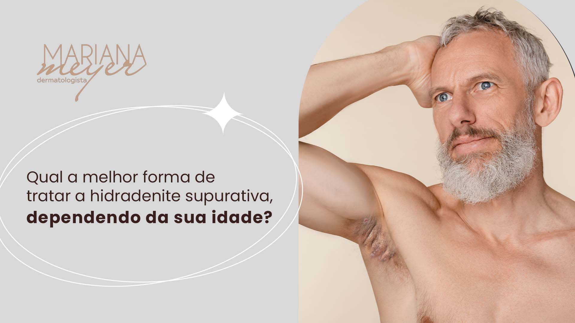 Homem idoso com hidradenite nas axilas e o seguinte texto: Qual a melhor forma de tratar a hidradenite supurativa, dependendo da sua idade.