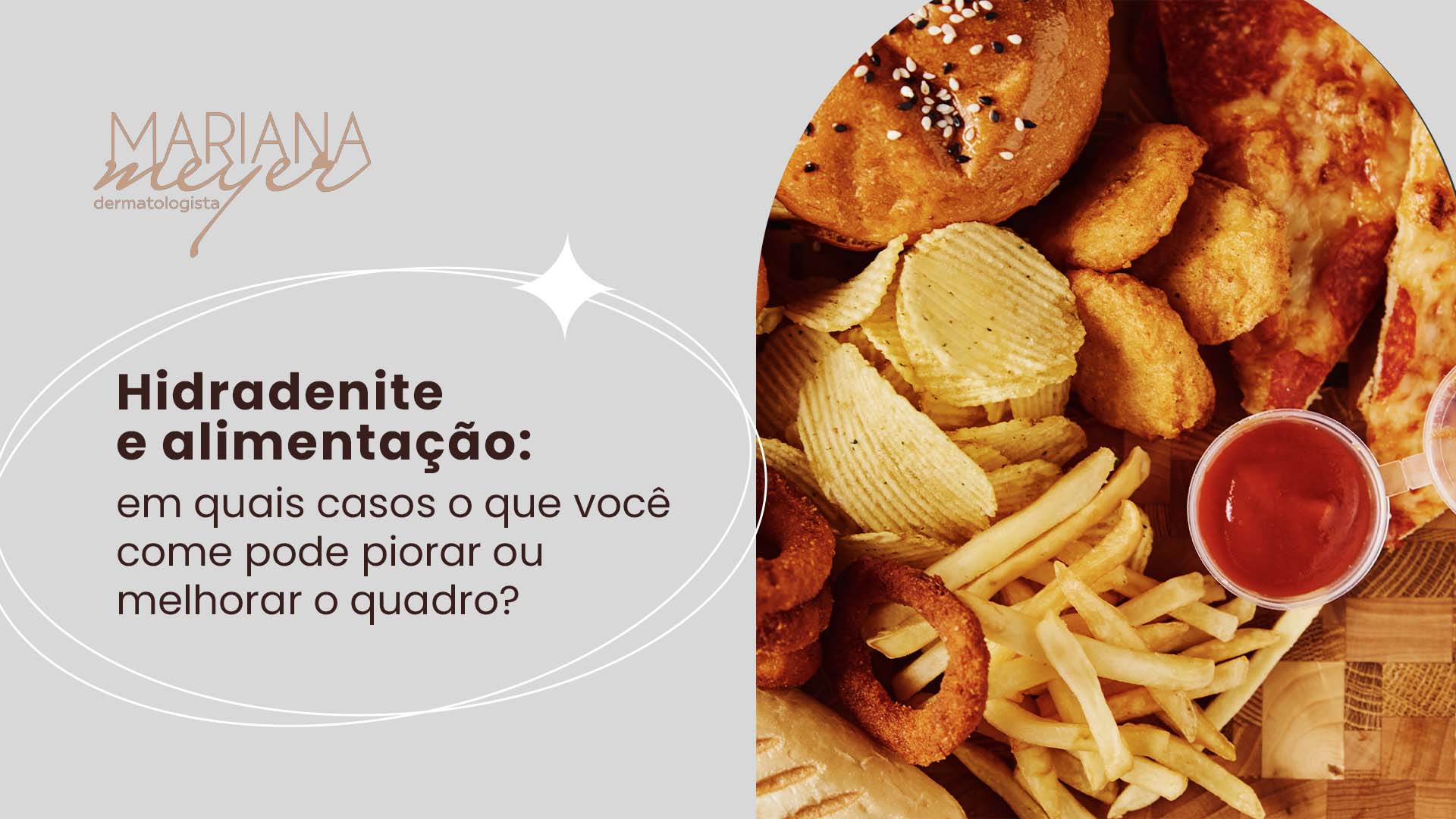 Vários alimentos gordurosos em cima de uma mesa e o seguinte texto: Hidradenite e alimentação: em quais casos o que você come pode piorar ou melhorar o quadro?