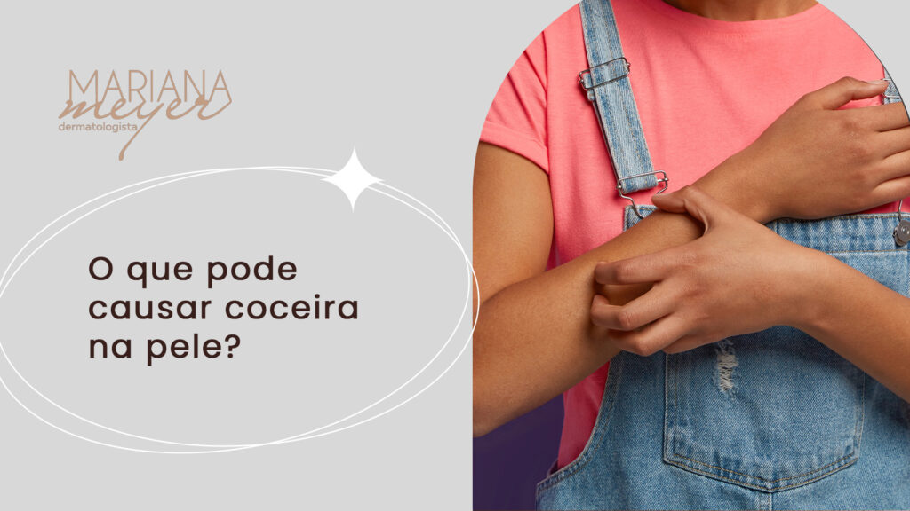 Mulher coçando o braço e o seguinte texto: O que pode causar coceira na pele?