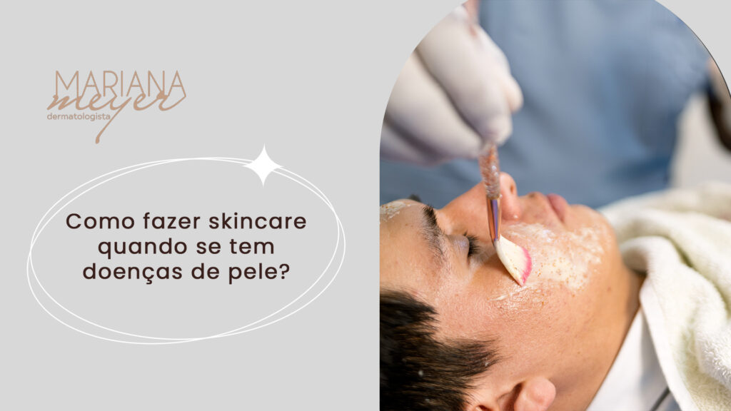 Dermatologista passando produto no rosto de paciente com um pincel e o seguinte texto: Como fazer skin care quando se tem doenças de pele?