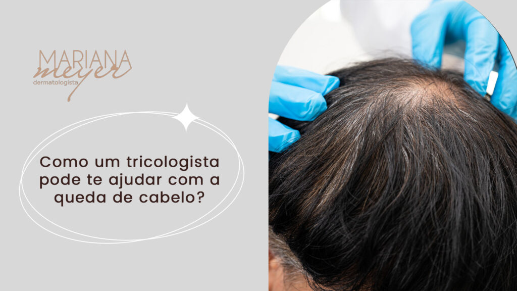 Dermatologista analisando couro cabeludo de um paciente e o seguinte texto: Como um tricologista pode te ajudar com a queda de cabelo?