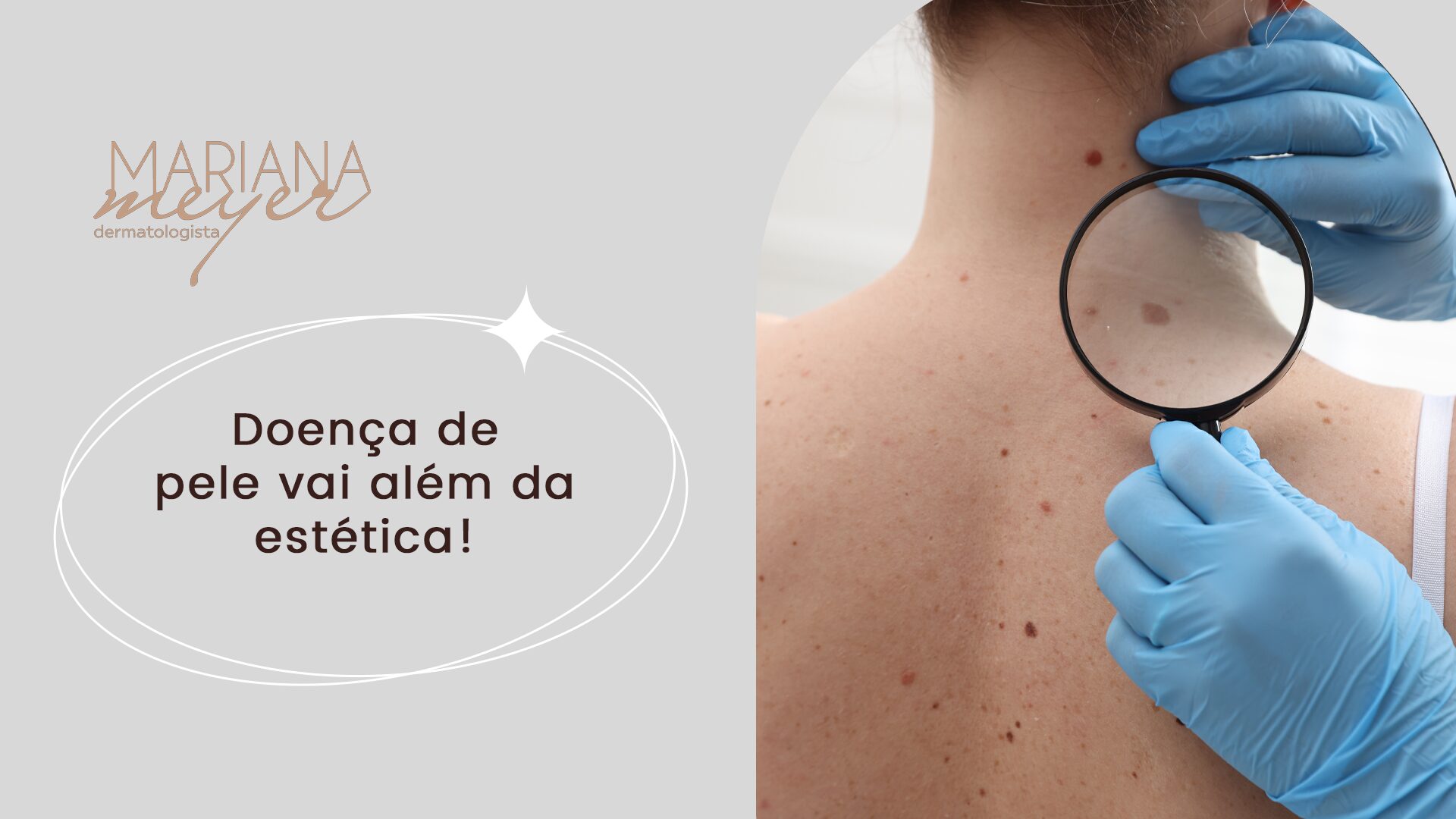 Médica analisando manchas nas costas de um rapaz com uma lupa e o seguinte texto: Doença de pele vai além da estética!